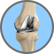 minimally_invasive_knee_tab